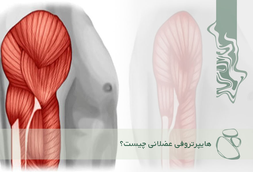 چرا عضلات رشد نمی‌کنند؟ کالبدشکافی هایپرتروفی و قوانین تحریک رشد عضله